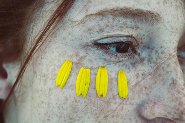 Skin type reaction